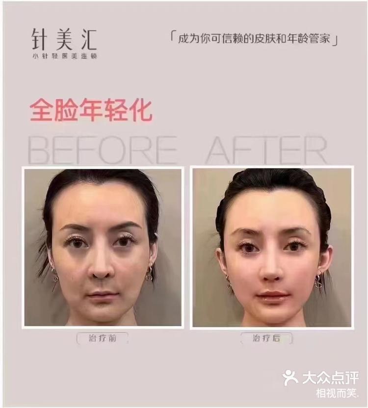 【针美汇】 你的年龄管家95全脸抗衰:-大众点评