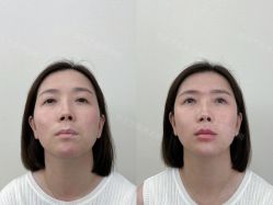 -Yestar艺星医疗美容医院