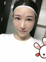 点击看大图 -大麦微针植发丨全国连锁