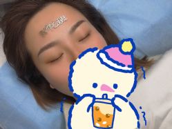 体验后-郡艺医疗美容·微整·眼鼻吸脂