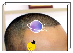 -大麦微针植发全国连锁