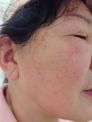 -长沙雅美医疗美容医院