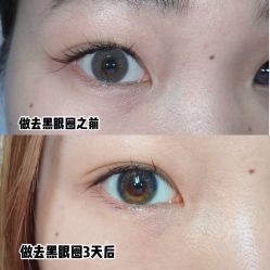 体验前-紫洁俪方（北京）医疗美容