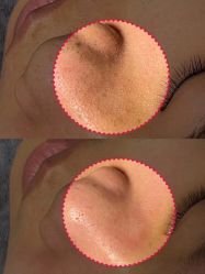 -美肤盾祛痘·问题肌头疗管理中心