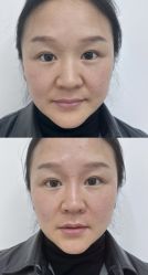 -Yestar重庆艺星医疗美容医院