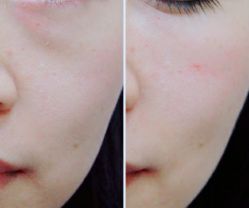 -SKINIST丽铂医疗美容