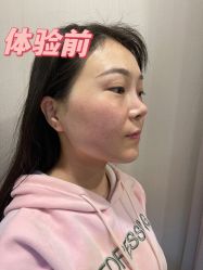 体验前-圣嘉新医疗美容医院