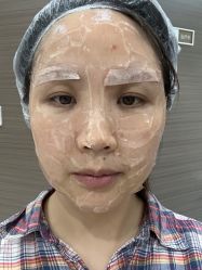 体验前-上海漾颜医疗美容