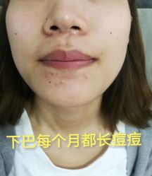 -成都军建医院·疤痕诊疗中心