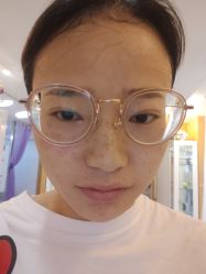 体验后-深圳美莱医疗美容医院