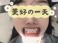 -团圆口腔·种植中心(锦江院区)