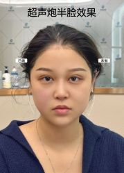 -烟台曙光医疗美容医院