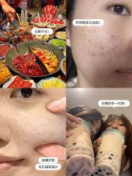 -凡碧诗毛孔清洁收细