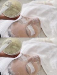 -美肤盾祛痘·问题肌头疗管理中心