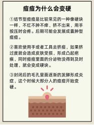 -悟空祛痘·诺奖技术专业店