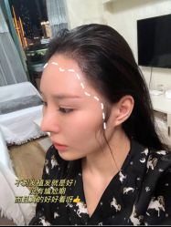 -雍禾植发全国连锁