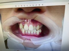 -宁波壹加壹口腔·矫正种植中心