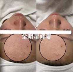 -LUNA皮相美·骨相美高级美感