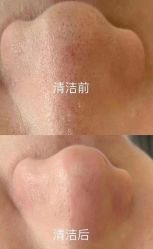 -美肤盾祛痘·问题肌头疗管理中心