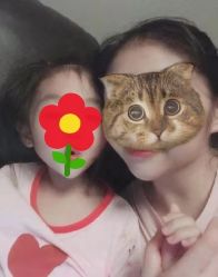 -碧莲盛·不剃发植发