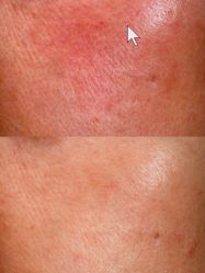 -深圳芙必优医疗美容·抗衰中心