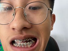 -深圳佑诺口腔门诊部