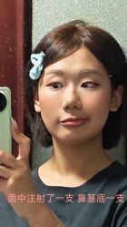 -北京叶子整形美容医院