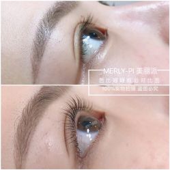 -MLP美丽派·问题肌疗愈中心