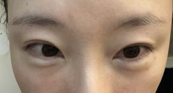 -纯粹医美