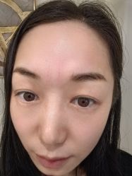 -海涛医疗美容·面部抗衰·注射美鼻