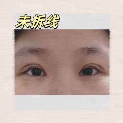 -素美医疗美容·西南眼鼻整形·修复基地
