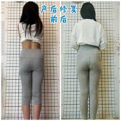 -蓝丝带产后恢复中心(都江堰店)