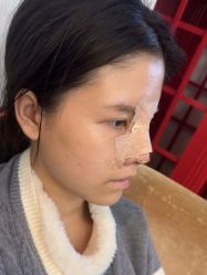 体验后-深圳广和门诊部·整形医疗美容