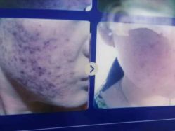 点击看大图 -成都军建医院·疤痕诊疗中心