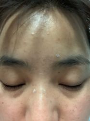 -北京美痣堂古方祛痣斑疣瘊