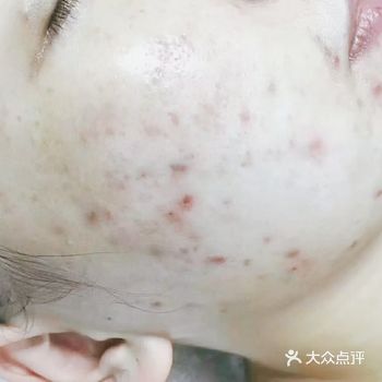 1、不要经常用热水洗脸，或者洗后用冷水再冲一遍