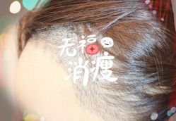 -大麦微针植发全国连锁