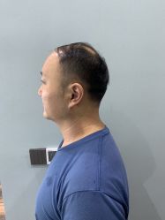 -极客侠男士假发定制补发
