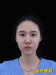 -丰联丽格医疗美容·联合丽格眼整形中心