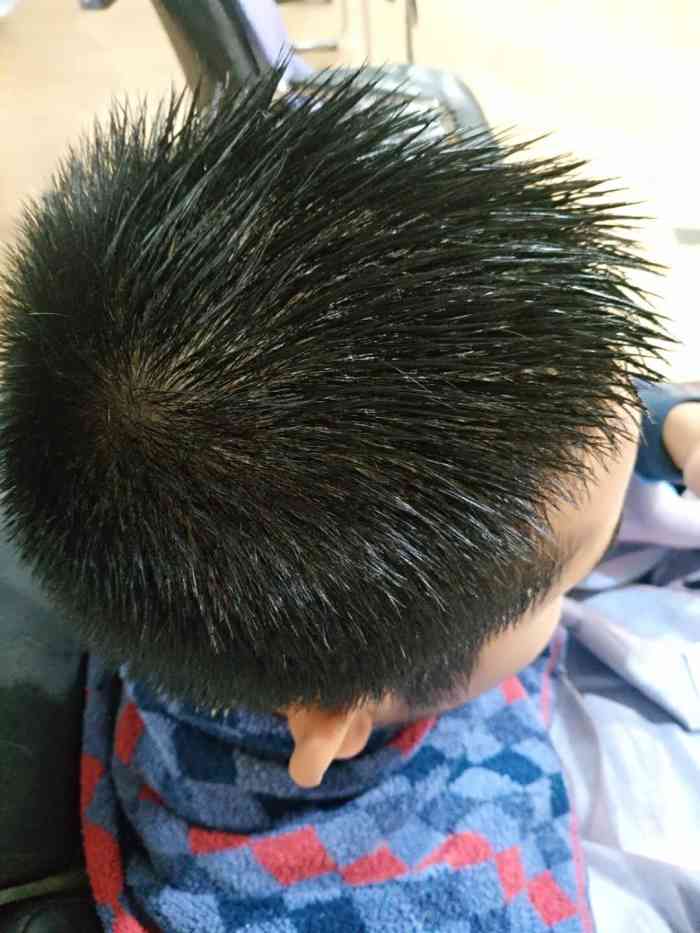 黑茸老姜王脱发生发 白发转黑