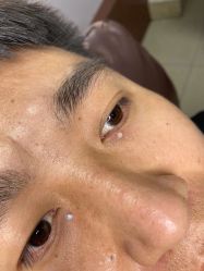 -百年美肤堂祛痦痣祛斑祛疣