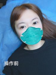 -西施无菌半永久纹绣眉眼影唇轻增发纹发际线