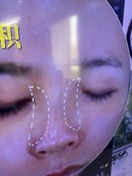 -广州美莱医疗美容医院
