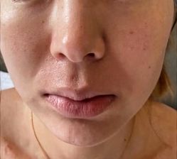 -天津健丽·去眼袋医疗美容机构