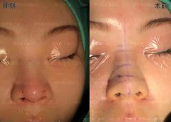 -北京米扬丽格医疗美容·联合丽格鼻整形中心