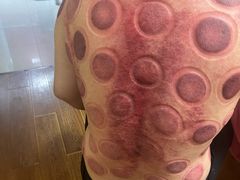 -沈师傅盲人按摩工作室(密三小区店)