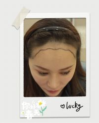 点击看大图 -大麦微针植发全国连锁