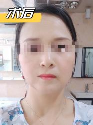 -素美医疗美容·西南眼鼻整形·修复基地