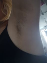 -玉笙美肤·专业脱毛中心