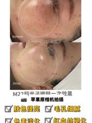 -E.beauty驻颜·痘敏肌调理中心
